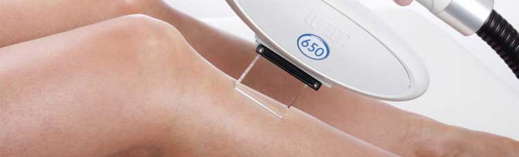 Permanent Hair Removal IPL